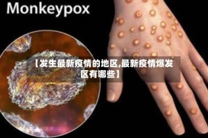 【发生最新疫情的地区,最新疫情爆发区有哪些】