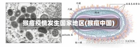 猴痘疫情发生国家地区(猴痘中国)-第2张图片